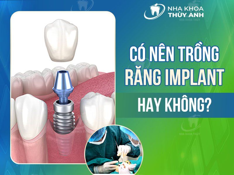 Răng implant bên cạnh răng thật