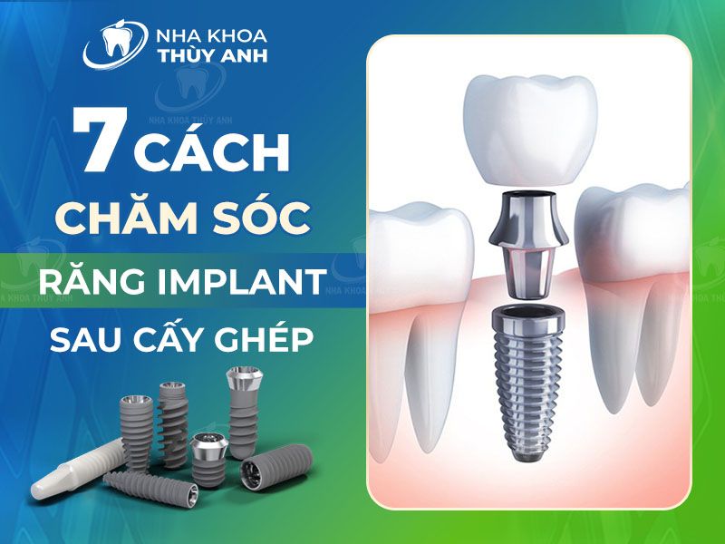 Chăm sóc răng implant sau phẫu thuật