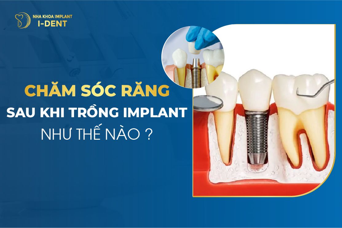 chăm sóc sau cấy ghép