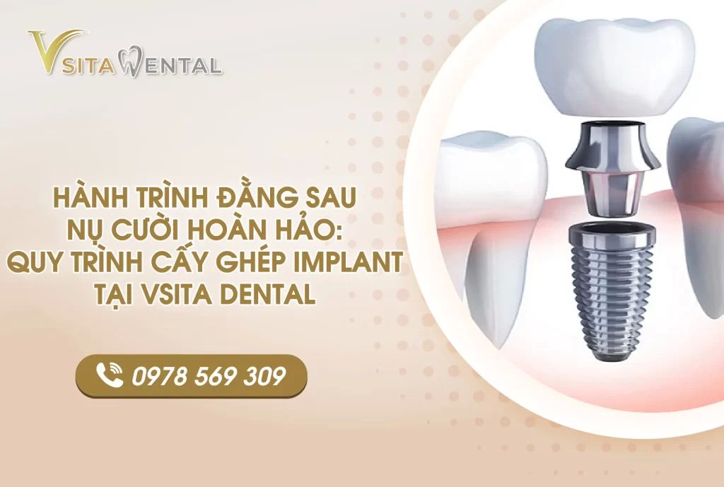 Nụ cười hoàn hảo sau khi trồng răng implant