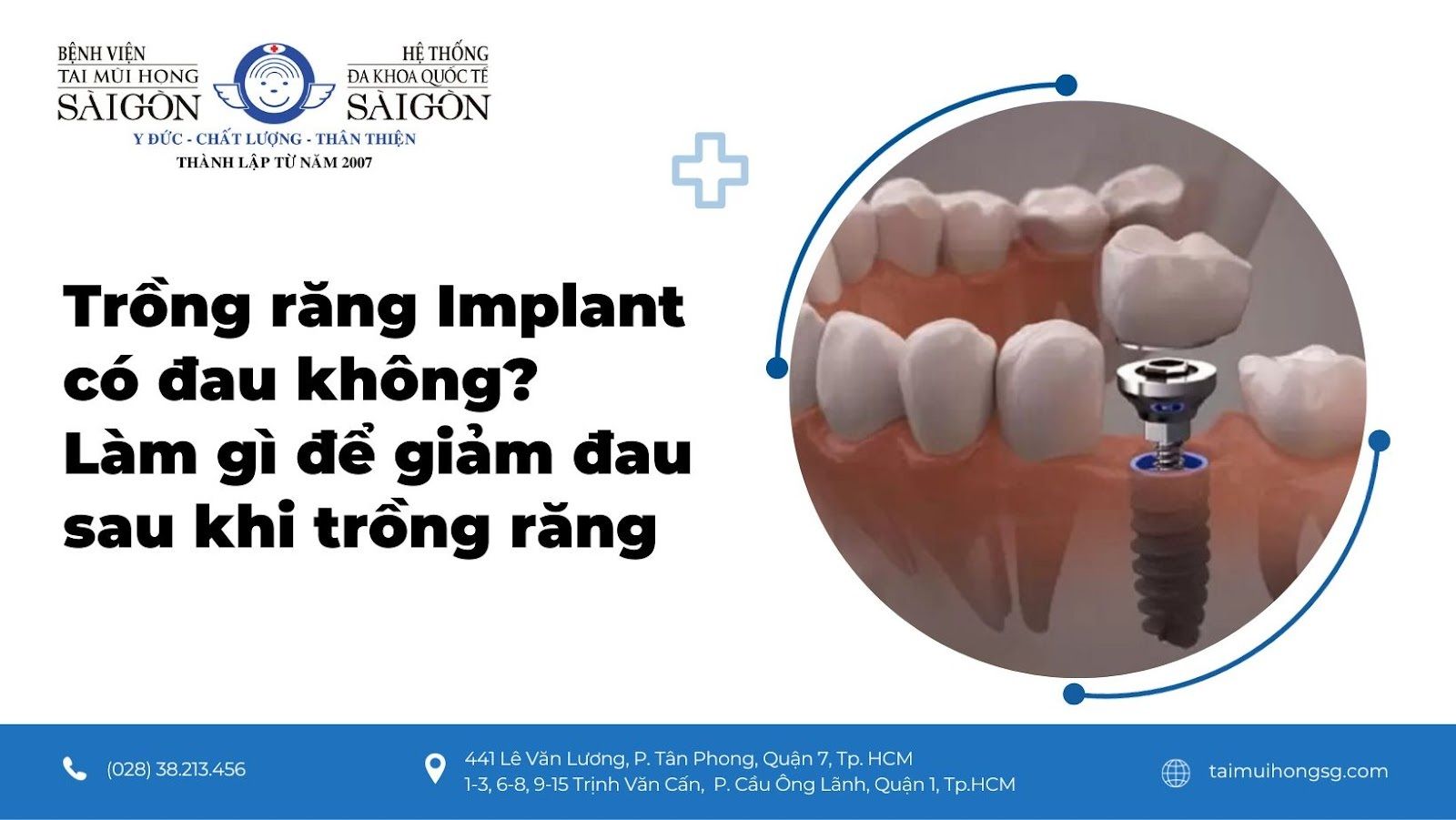 Làm răng implant có đau không