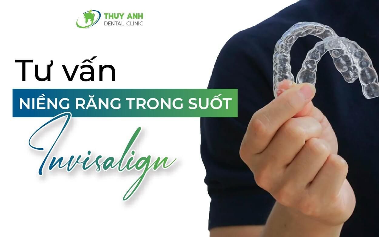 Nha sĩ tư vấn niềng răng