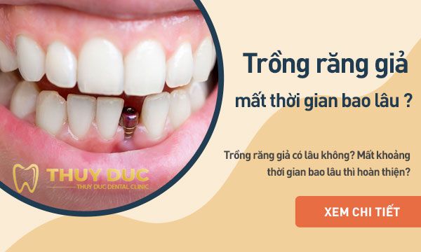 Răng sứ hoàn thiện