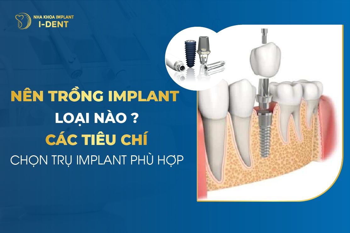 Trụ Implant